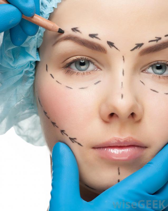 Different Types Of Facial Plastic Surgery Procedures